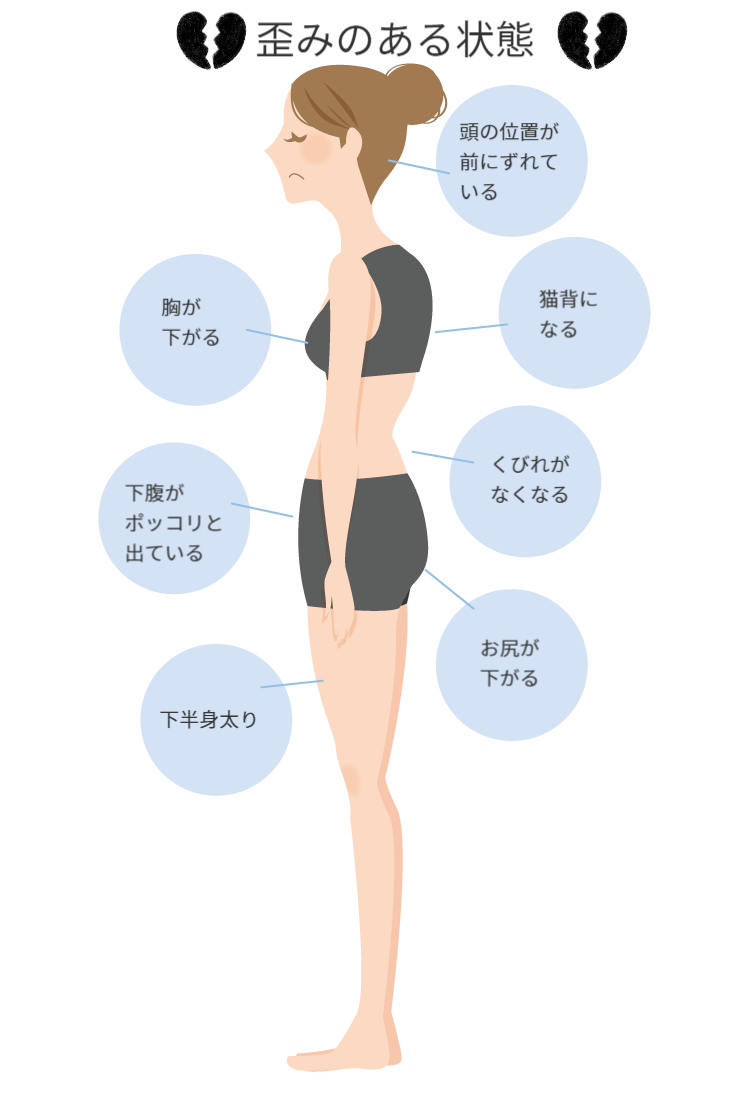 歪みのある状態のイラスト